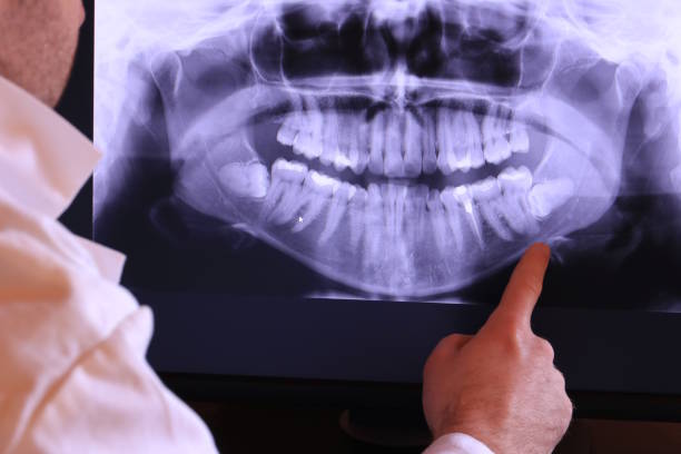 Best Emergency Tooth Extraction in West Branch, IA