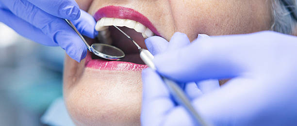 Best Emergency Wisdom Teeth Removal in West Branch, IA